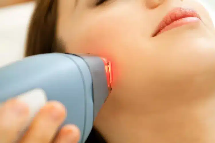 Cosmetic Laser Treatments